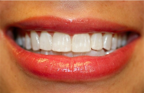 Причины, влияющие на чувствительность зубов