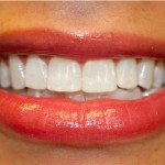 Причины, влияющие на чувствительность зубов